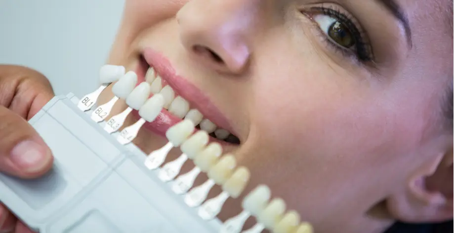 Teeth Whitening Explained